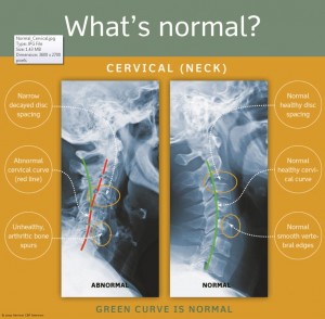 1. Normal_Cervical