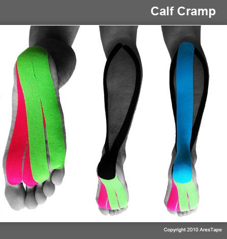 calf_cramp