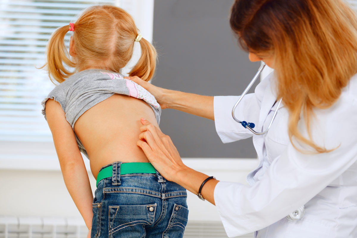 Scoliosis in Children & Adolescents | Circle of Docs