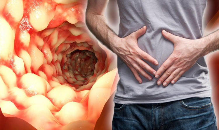 How Chiropractors Can Help Patients with Crohn's Disease | Circle 